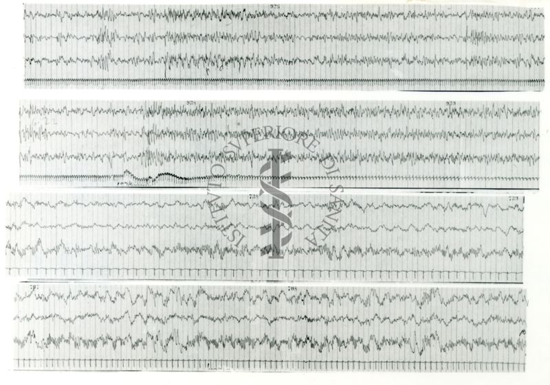 Tracciati elettroencefalografici di coniglio