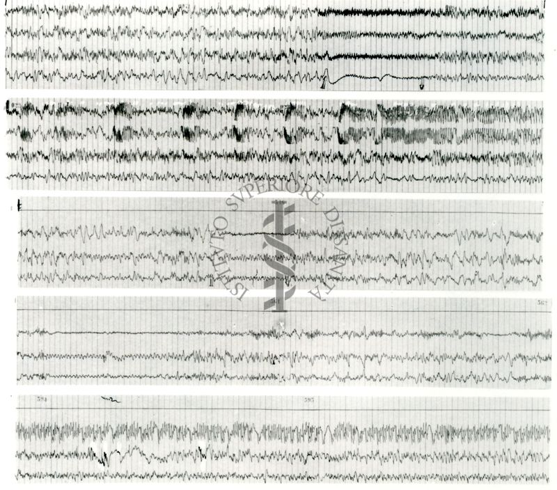 Tracciati elettroencefalografici di coniglio