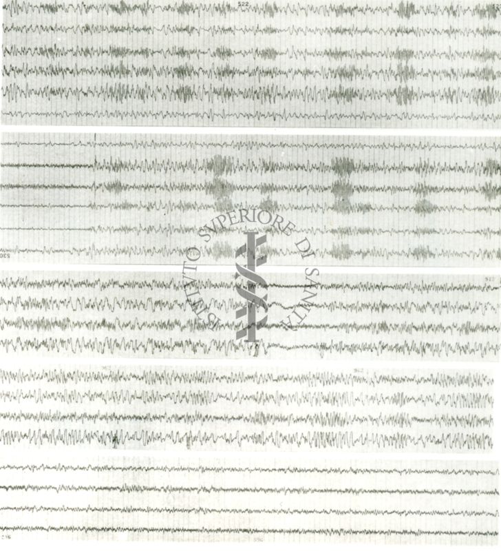 Tracciati elettroencefalografici di coniglio