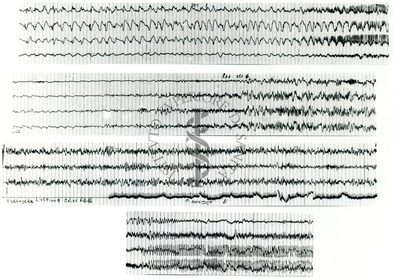 Tracciati elettroencefalografici di coniglio