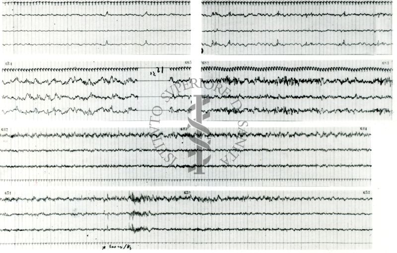 Tracciati elettroencefalografici di coniglio