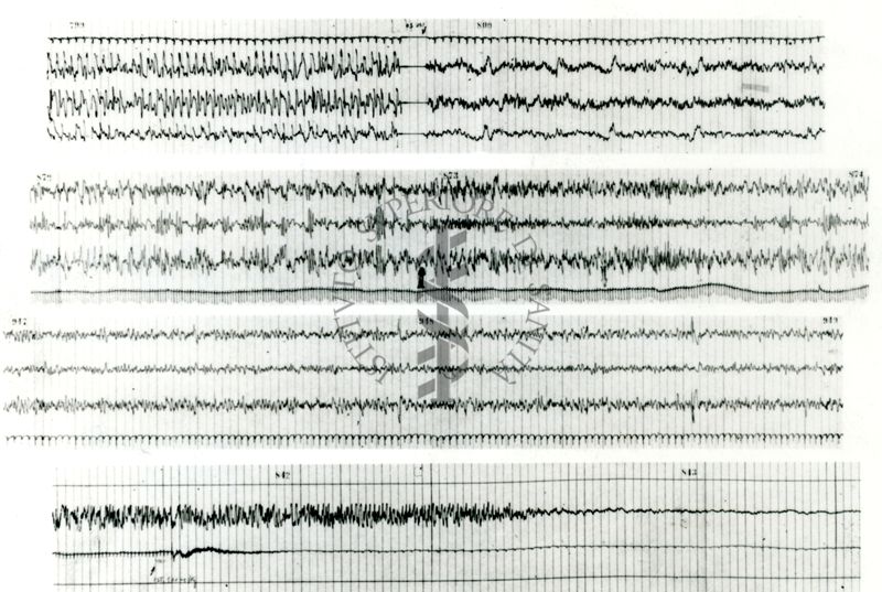 Tracciati elettroencefalografici di coniglio