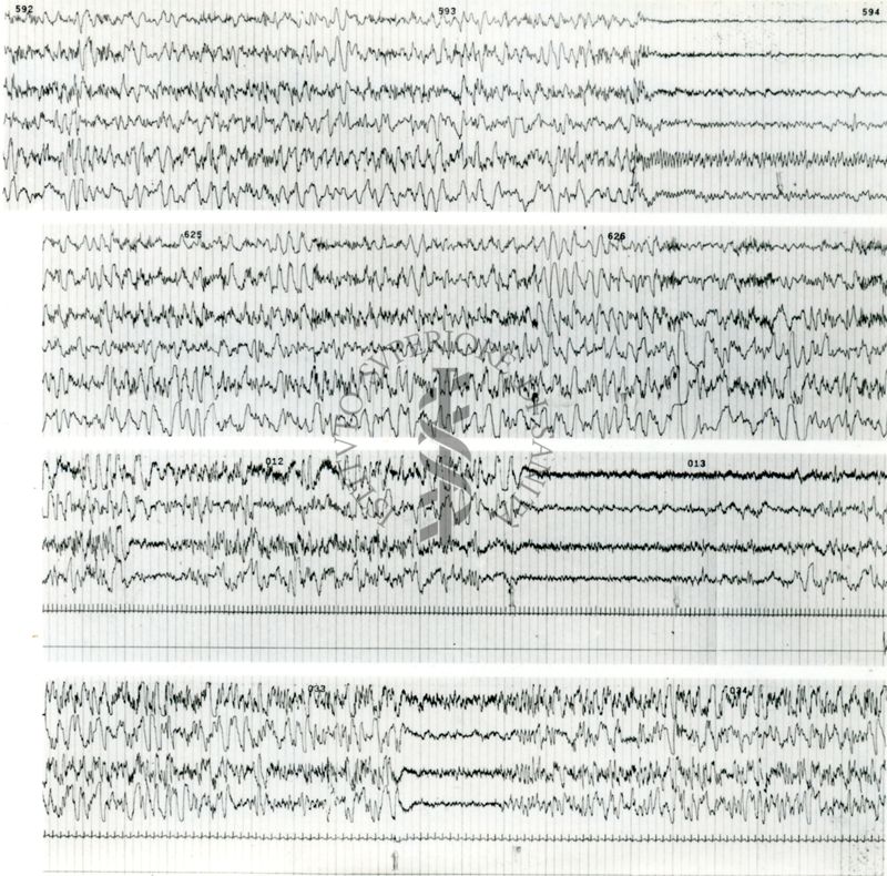 Tracciati elettroencefalografici di coniglio