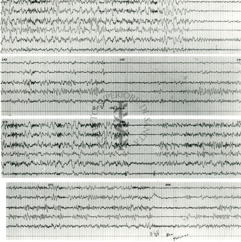 Tracciati elettroencefalografici di coniglio