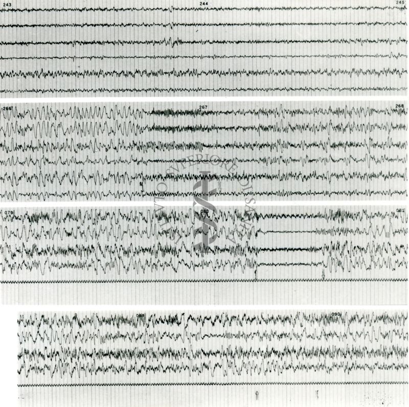 Tracciati elettroencefalografici di coniglio