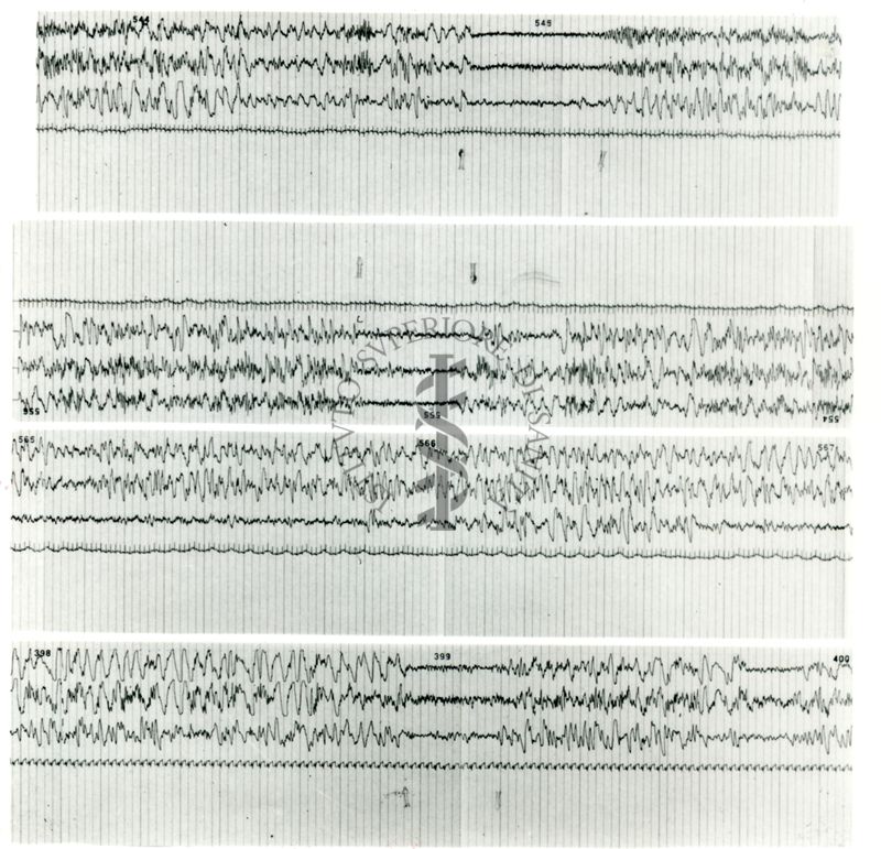 Tracciati elettroencefalografici di coniglio