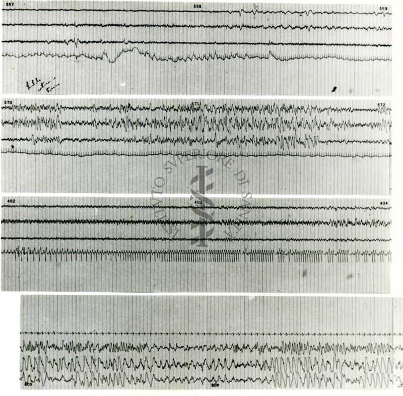 Tracciati elettroencefalografici di coniglio