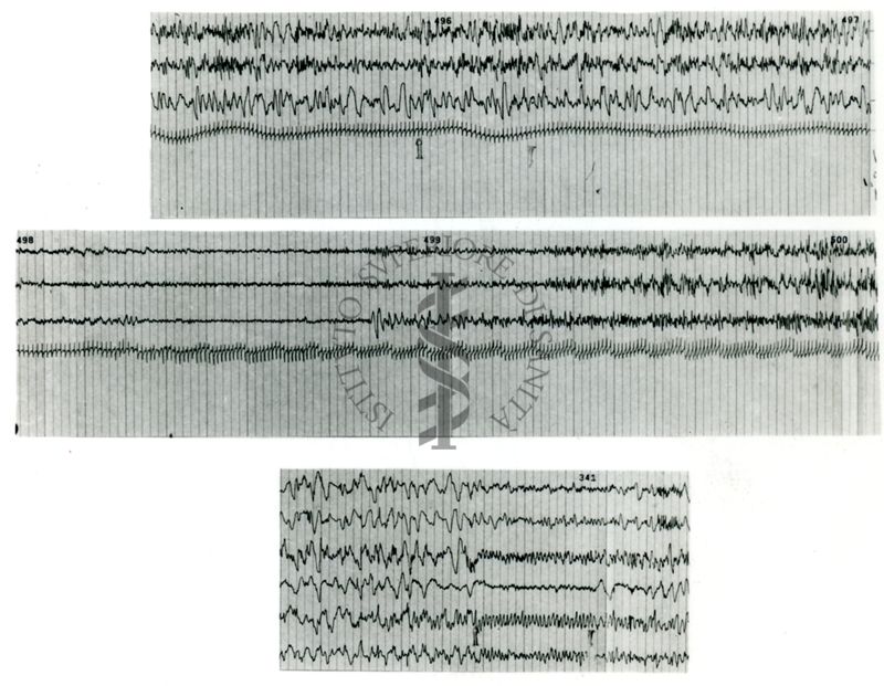 Tracciati elettroencefalografici di coniglio