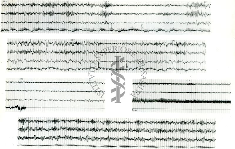 Tracciati elettroencefalografici di coniglio