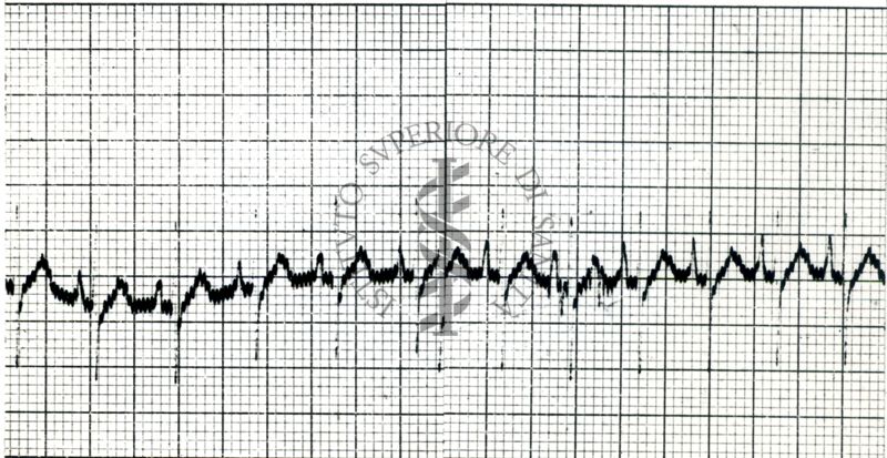 A. - Curaro - Azione del Flaxedil su ECG del cane (2 mg/kg). 1 - ECG normale - 2 - dopo Flaxedil