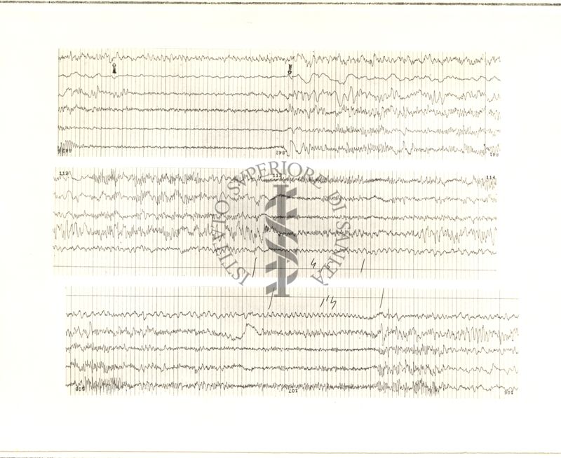 Tracciati elettroncefalografici di coniglio