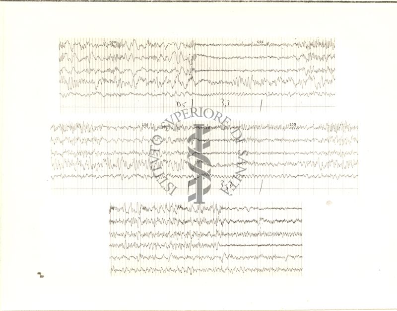 Tracciati elettroncefalografici di coniglio