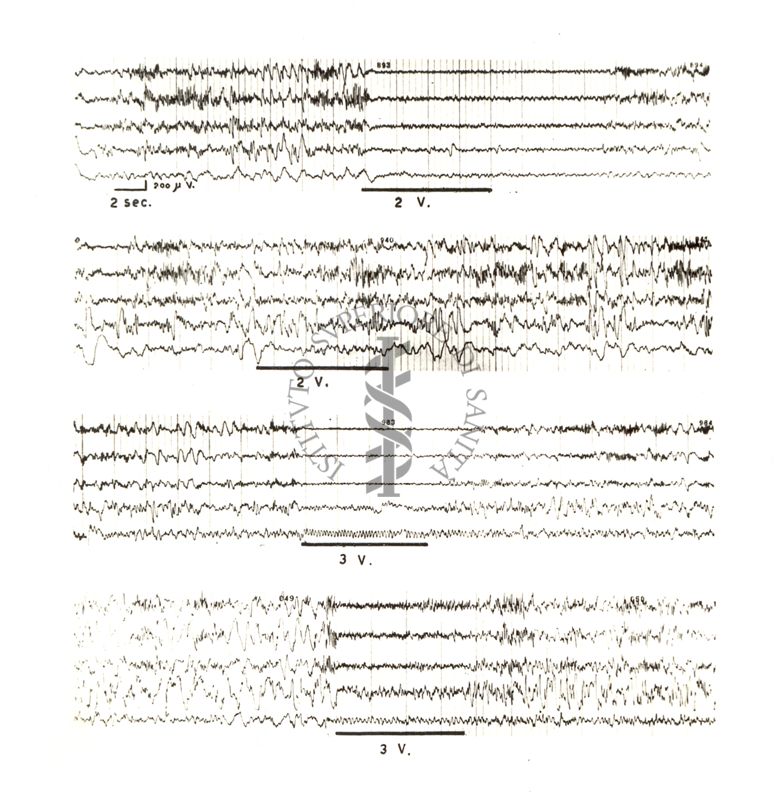 Tracciati elettroncefalografici di coniglio