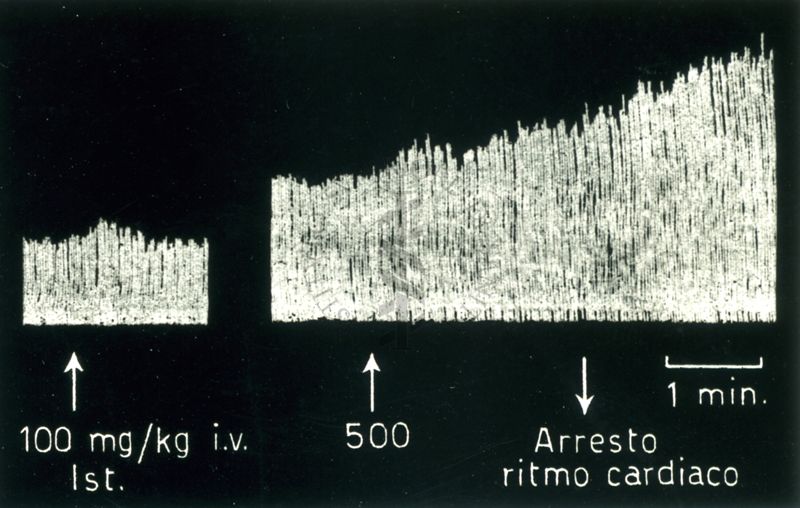 Tracciati broncografici