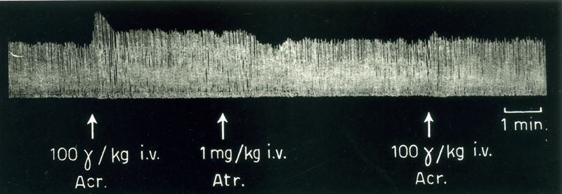 Tracciati broncografici