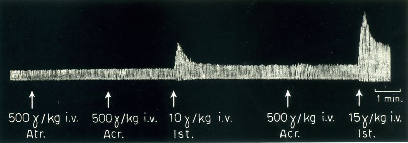 Tracciati broncografici