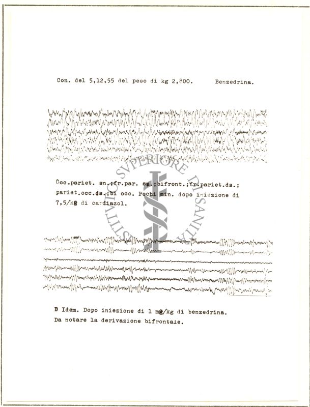 Elettroncefalogrammi di coniglio