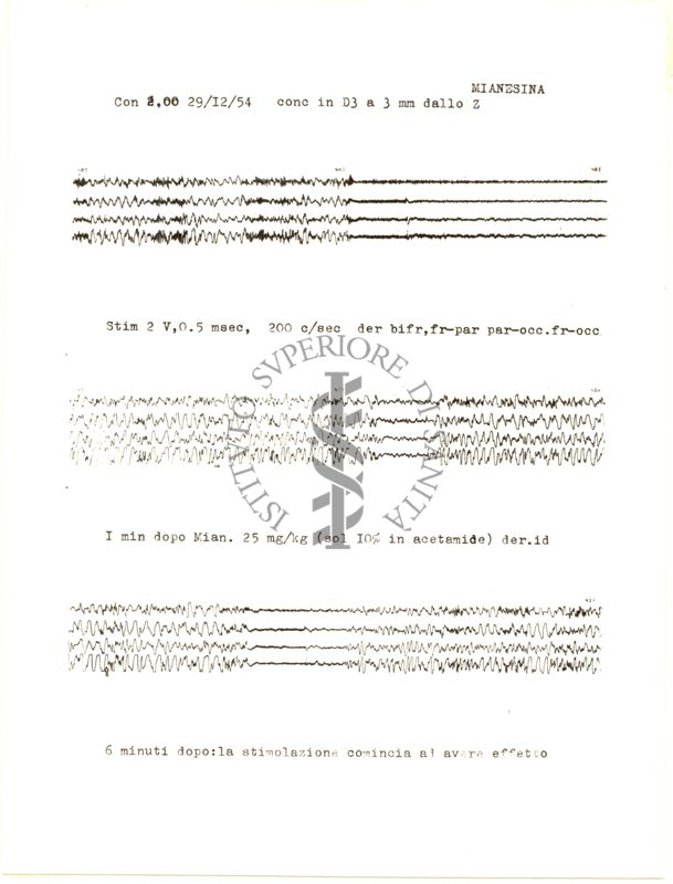 Elettroncefalogrammi di coniglio