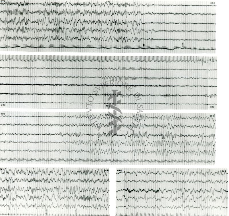 Tracciati elettroencefalografici di coniglio