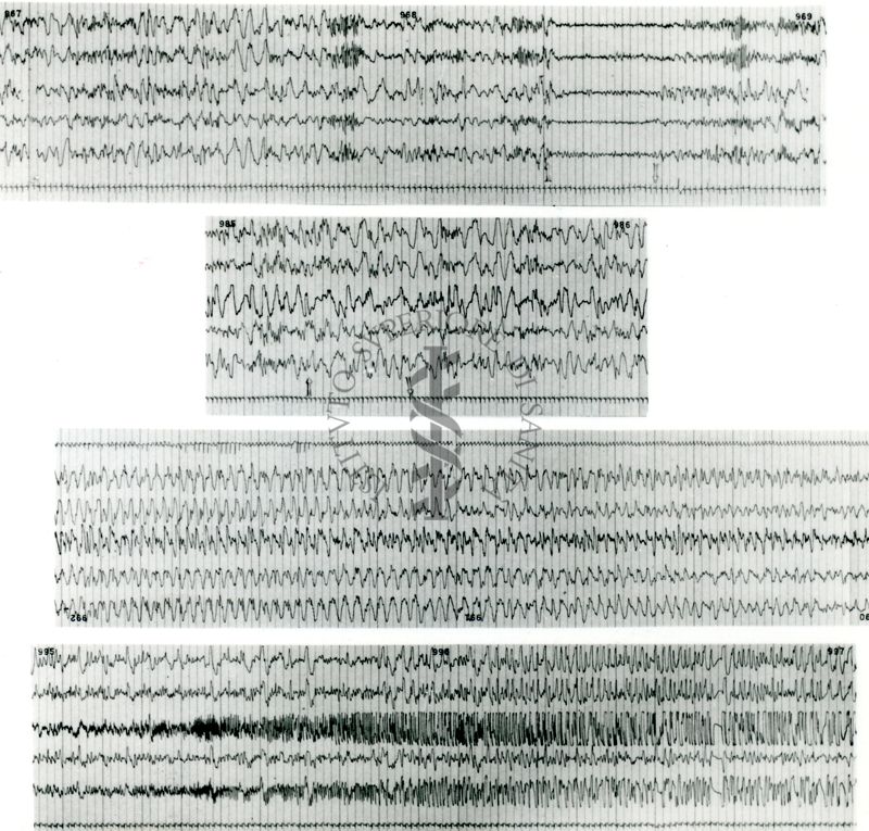 Tracciati elettroencefalografici di coniglio