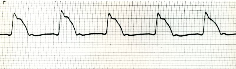 Sfigmogrammi del polso centrale del cane