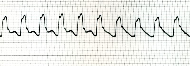 Sfigmogrammi del polso centrale del cane