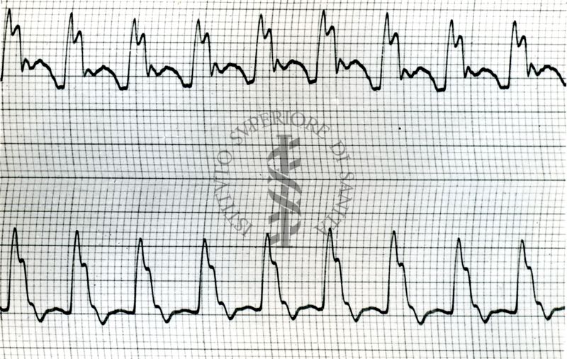 Sfigmogrammi del polso centrale del cane