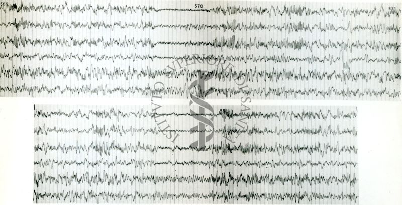 Tracciati elettroncefalografici di coniglio