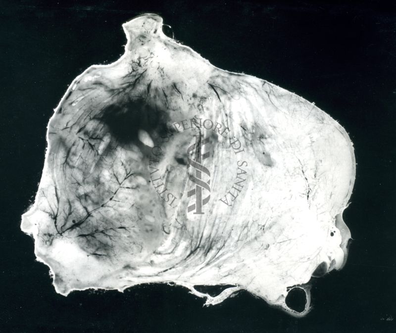 Immagine di stomaco di ratto - ricerche sulla protezione dell'ulcera gastrica sperimentale, mediante antirinaptici