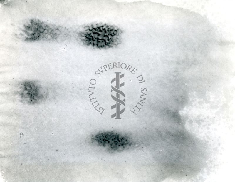 Immagine della separazione cromatografica di noradrenalina e adrenalina dalle surrenali