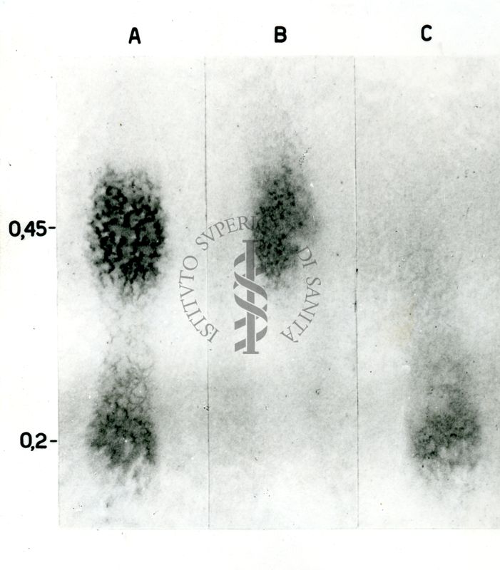 Immagini affiancate della separazione cromatografica di noradrenalina e adrenalina dalle surrenali