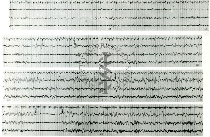 Tracciati elettroencefalografici di coniglio