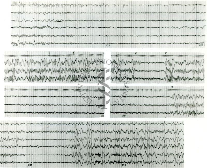 Tracciati elettroencefalografici di coniglio