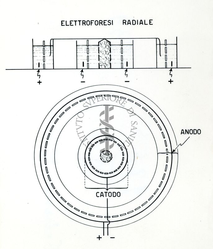 Schema elettroforesi Berlingozzi