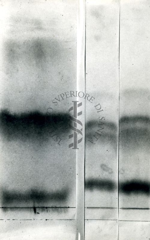 Elettroforesi corticoidi urine