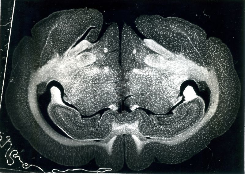 Sezioni di cervello di coniglio