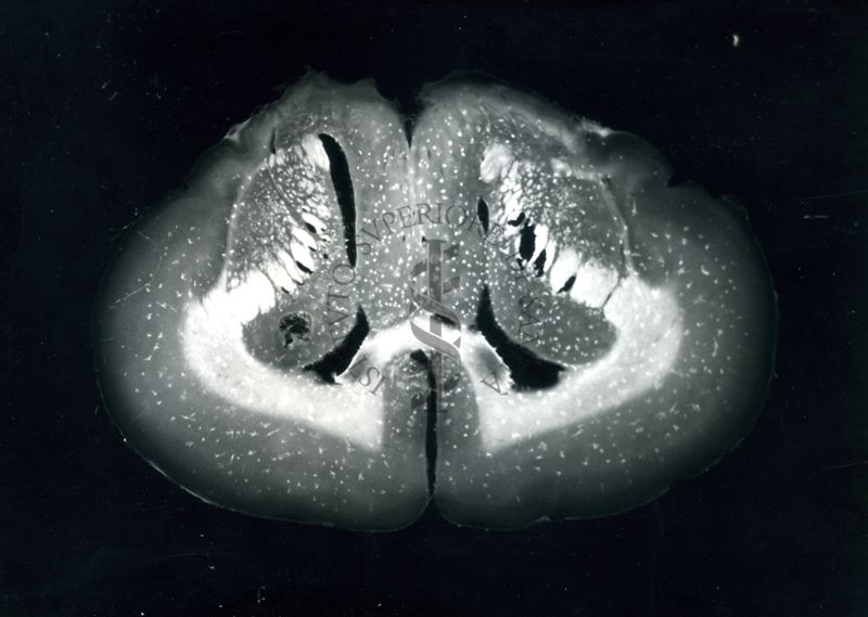 Sezioni di cervello di coniglio