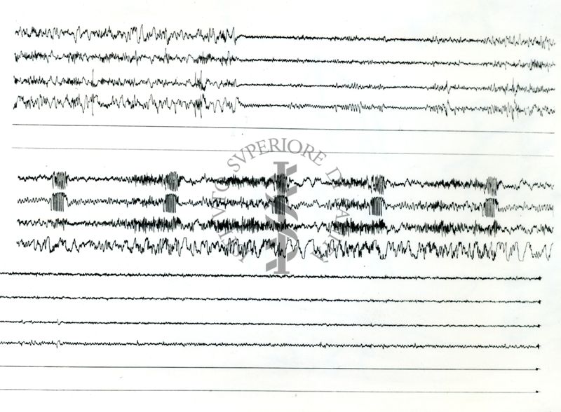 Tracciati elettroncefalografici di coniglio