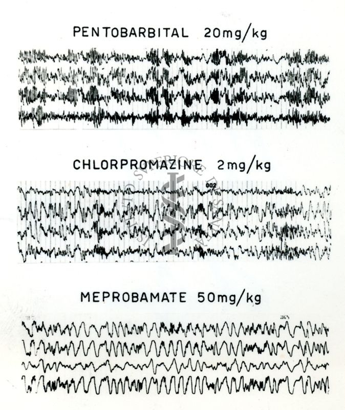 Tracciati elettroncefalografici di coniglio