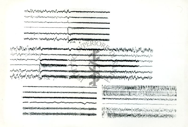 Tracciati elettroncefalografici di coniglio