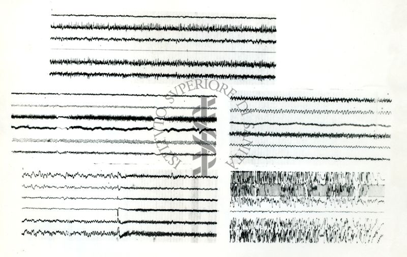 Tracciati elettroncefalografici di coniglio