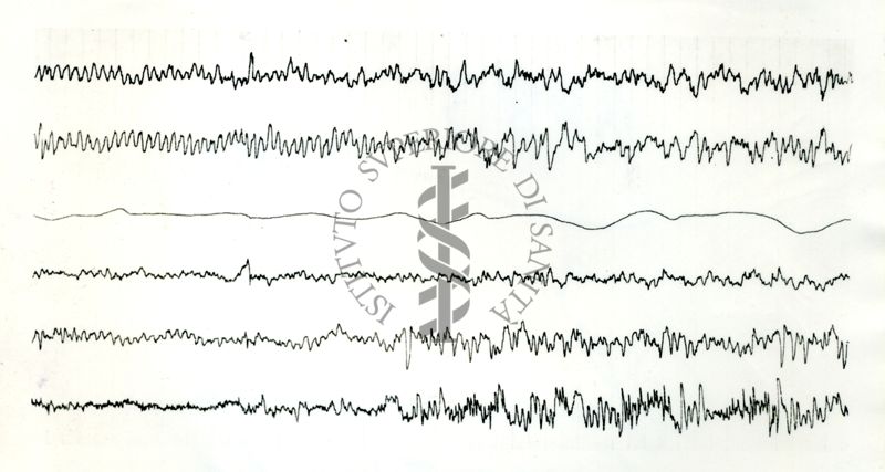 Tracciati elettroncefalografici di coniglio