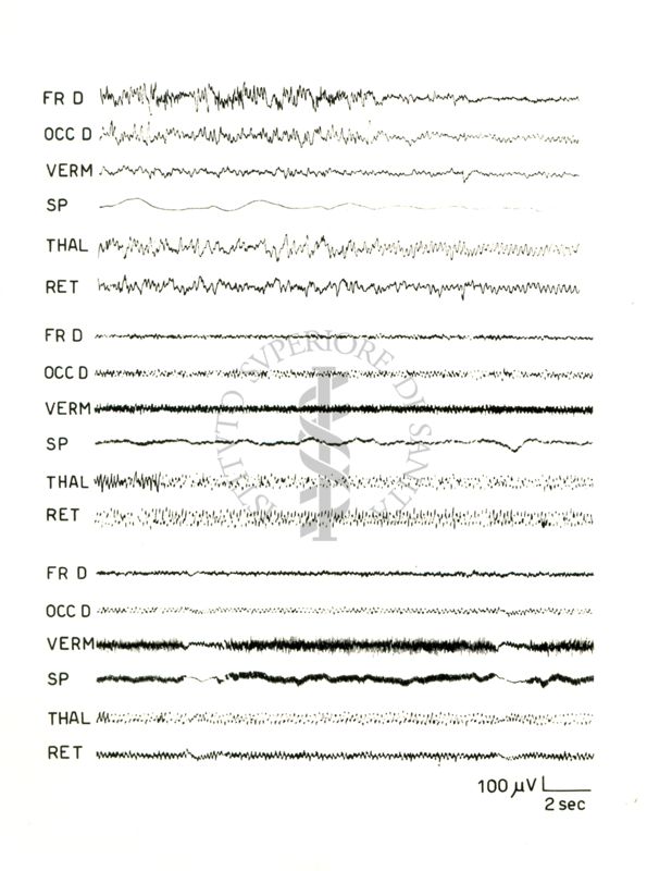 Tracciati elettroencefalografici di coniglio