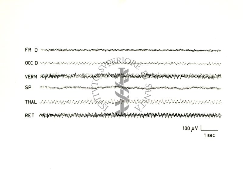 Tracciati elettroencefalografici di coniglio