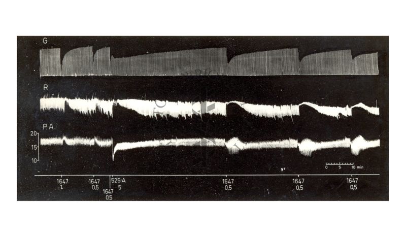 Reazioni sul m. gastroenemio del cane