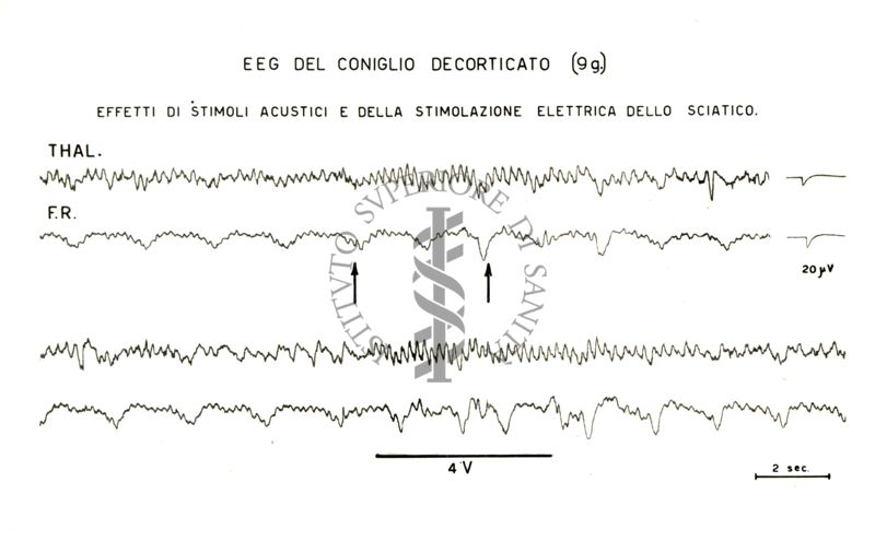 Tracciati elettroencefalografici di coniglio