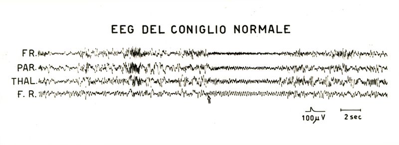 Tracciati elettroencefalografici di coniglio