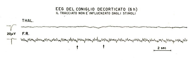 Tracciati elettroencefalografici di coniglio