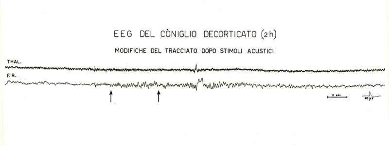 Tracciati elettroencefalografici di coniglio