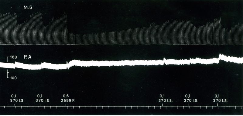 Azione del 2559 F. verso il 370 I.S.